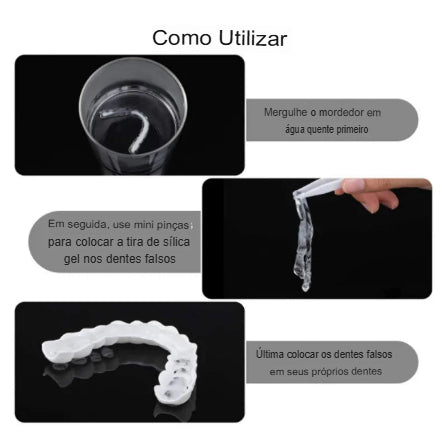 Smile Fit - Facetas Dentárias Removíveis