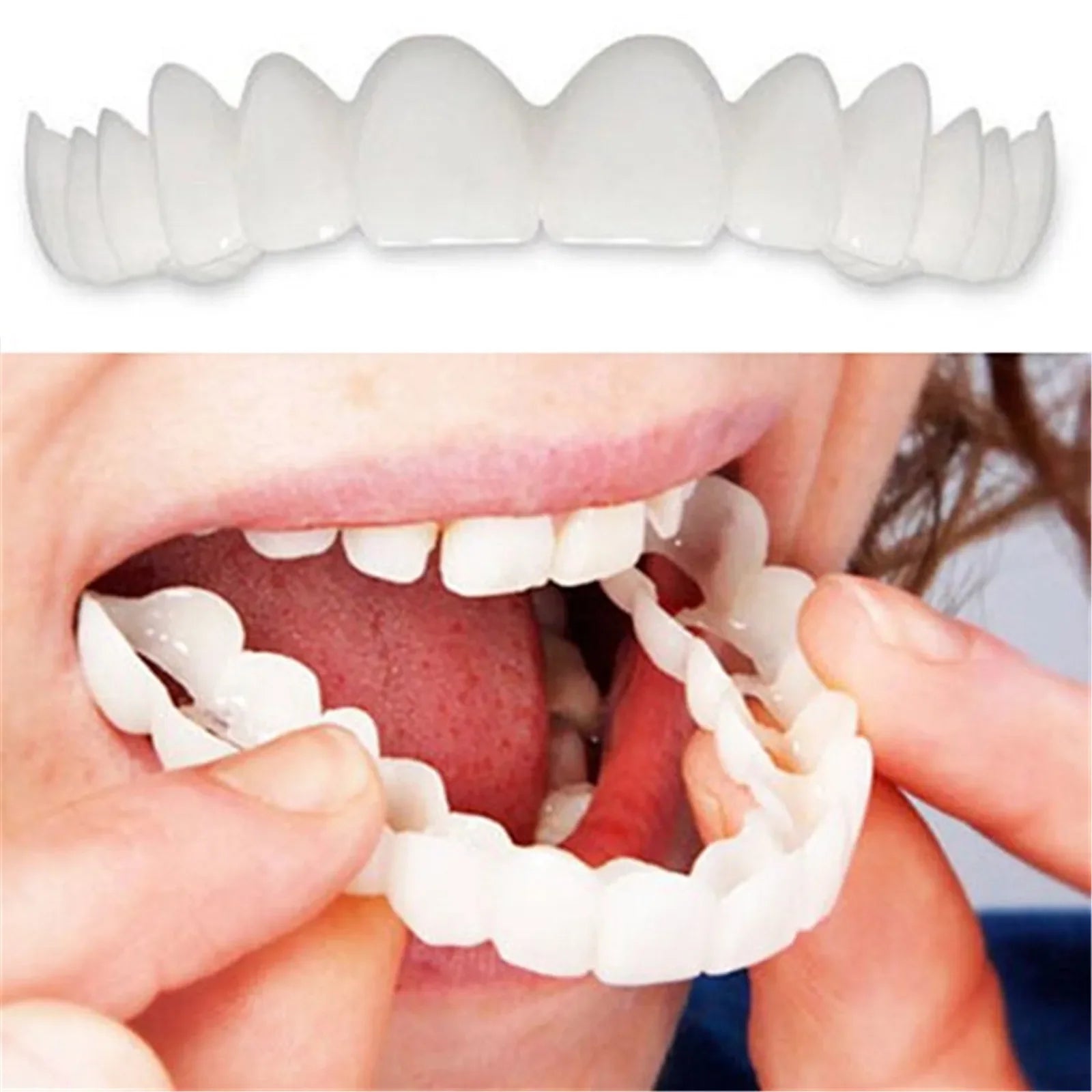 Smile Fit - Facetas Dentárias Removíveis